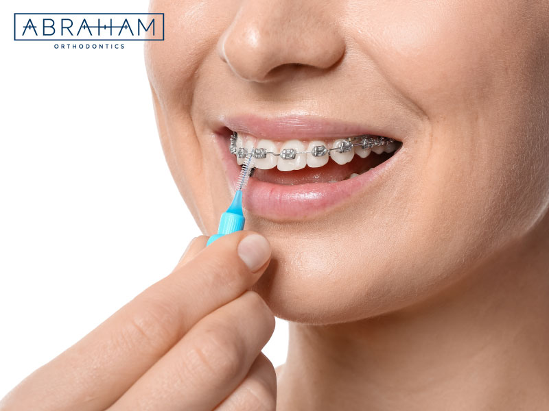 Good dental hygiene will allow you to keep a beautiful smile that's free of cavities.